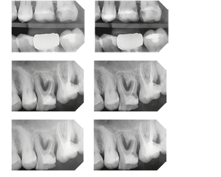 adaptive_multivision.png__700x510_q85_subsampling-2