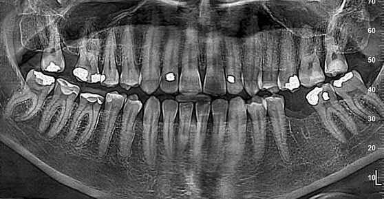 dentatura