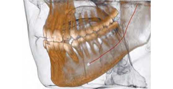 endodonto