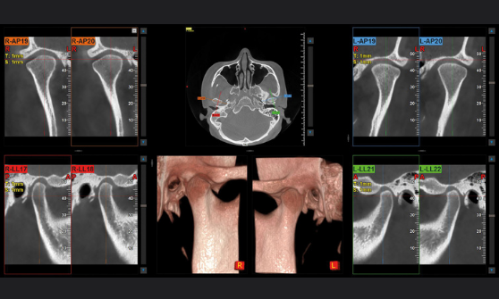 gnatologia_vista_doppia_atm_rid