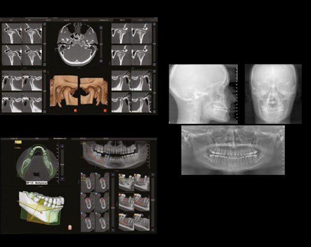 odontoiatria.jpg__700x510_q85_subsampling-2