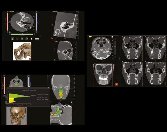 otorinolaringoiatria.jpg__700x510_q85_subsampling-2