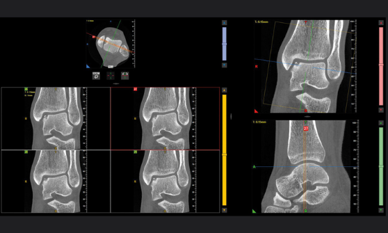 radiologia_analisi_multi-slice_rid