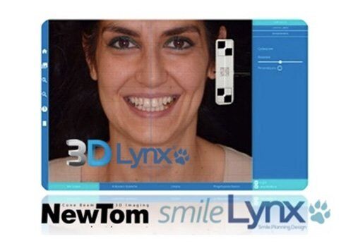 smile-lynx.jpg__700x510_q85_subsampling-2